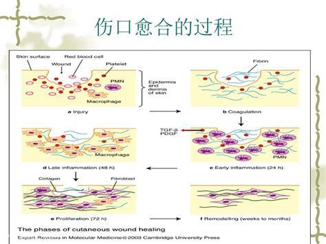 被龍魚咬爛的傷口會自愈嗎？，被龍魚咬爛的傷口是否會自愈