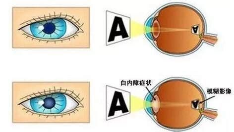如何區(qū)分龍魚眼球的白點是病還是其他原因？，如何判斷龍魚眼球上的白點是病還是其他原因