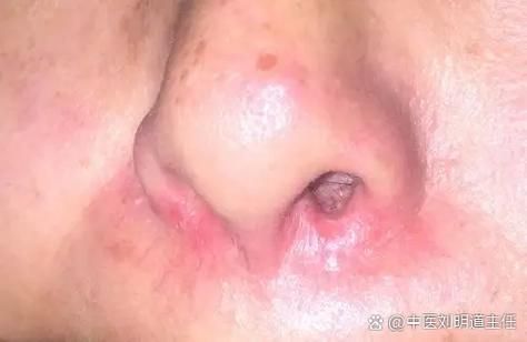 翻鰓硬化后多久能恢復，富媒體組件庫規則：翻鰓絲硬化后多久能恢復-