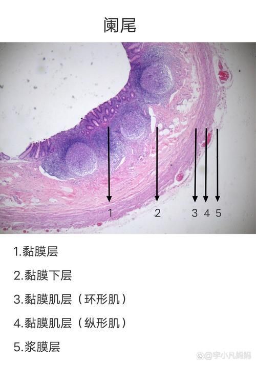腸梗阻對龍魚有哪些影響，腸梗阻對龍魚的影響