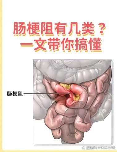 腸梗阻對龍魚有哪些影響，腸梗阻對龍魚的影響
