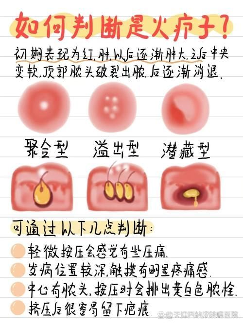 真菌和細菌感染的治療方法有哪些