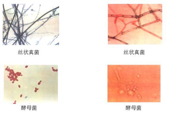 真菌和細菌感染的治療方法有哪些