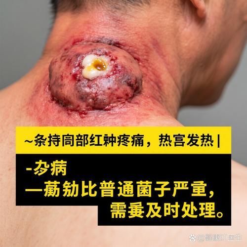真菌和細菌感染的治療方法有哪些
