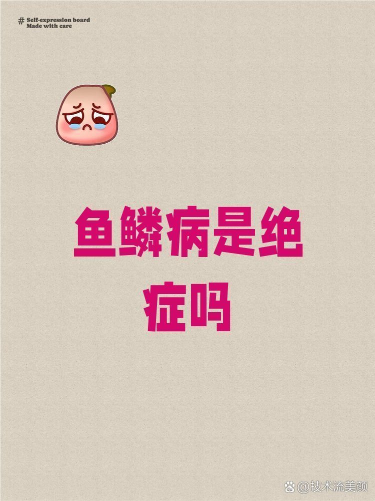 魚鱗病能徹底治愈嗎，魚鱗病是絕癥嗎