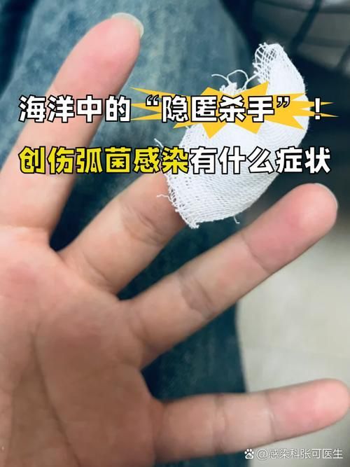 海洋弧菌感染早期圖片，感染海洋弧菌后多久會出現癥狀