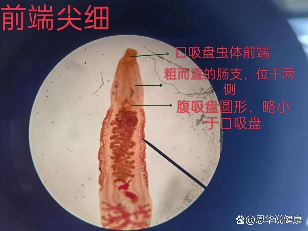 魚得寄生蟲怎么治療，arxiv論文助手（arxiv論文助手治療方案）