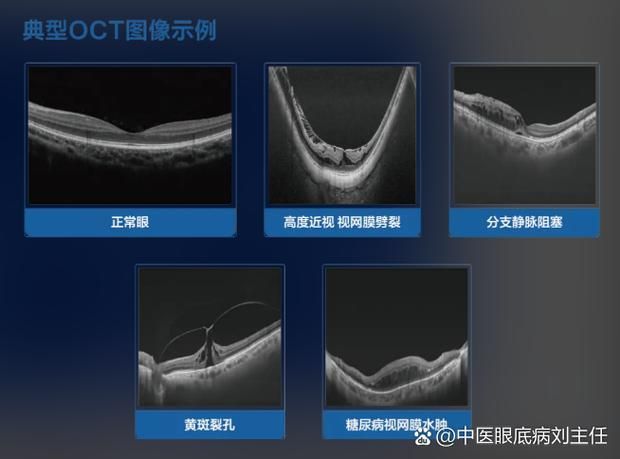 給我一份爛鰓病診斷對(duì)照表，———病原類(lèi)型、癥狀對(duì)照表