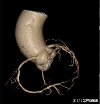 給我一份爛鰓病診斷對(duì)照表，———病原類(lèi)型、癥狀對(duì)照表