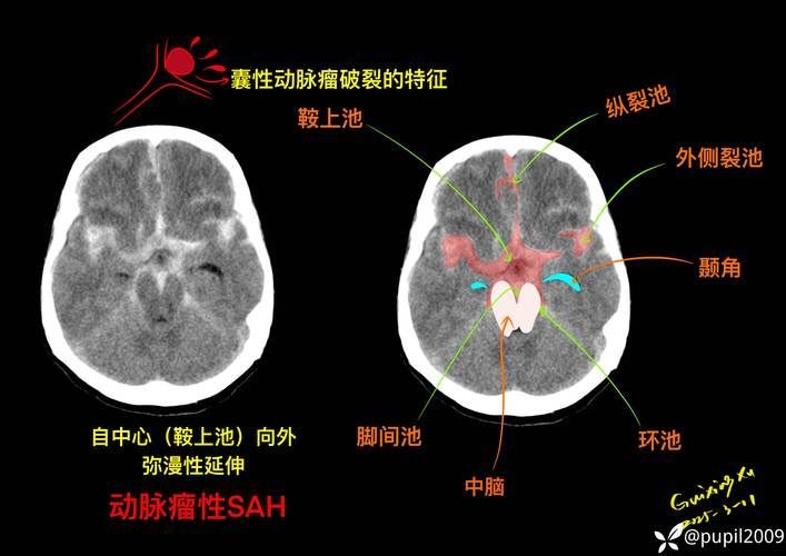 給我一份爛鰓病診斷對(duì)照表，———病原類(lèi)型、癥狀對(duì)照表