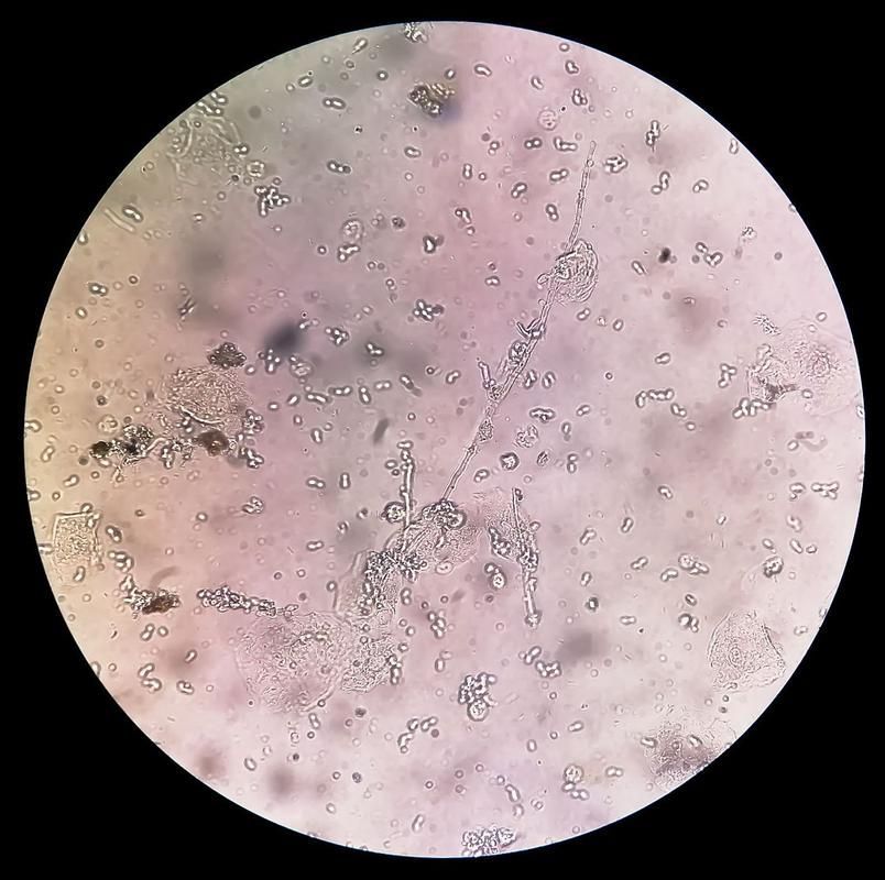 有哪些硝化細(xì)菌可以添加到龍魚(yú)缸中？，硝化細(xì)菌在龍魚(yú)缸中的應(yīng)用