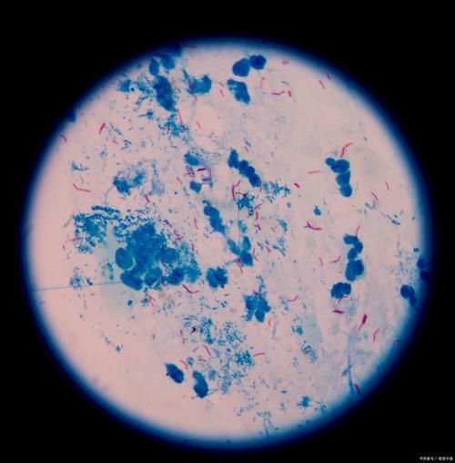 有哪些硝化細(xì)菌可以添加到龍魚(yú)缸中？，硝化細(xì)菌在龍魚(yú)缸中的應(yīng)用