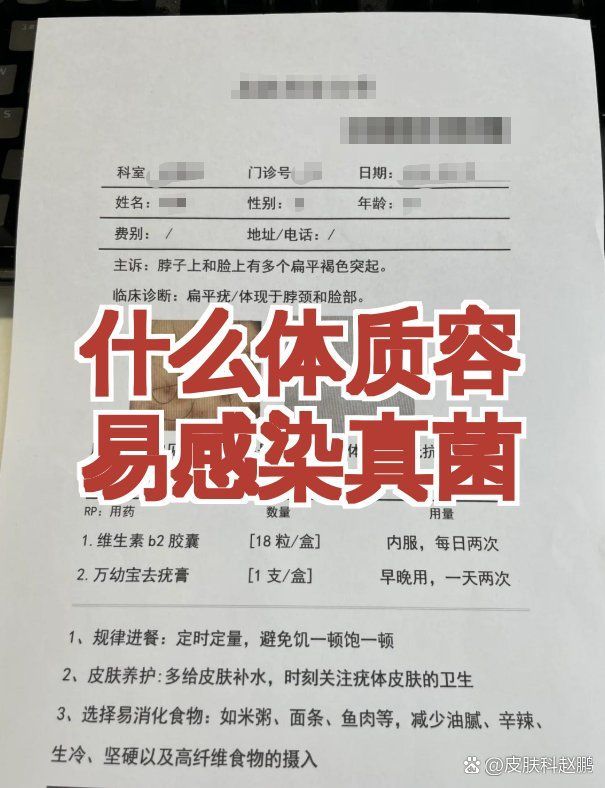 哪些人群更容易感染真菌，什么體質(zhì)容易感染真菌