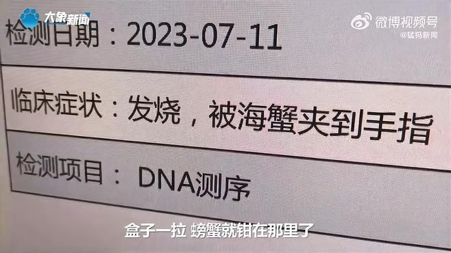 哪種海魚扎傷最容易感染，深圳多人被海魚扎傷后感染風險最高