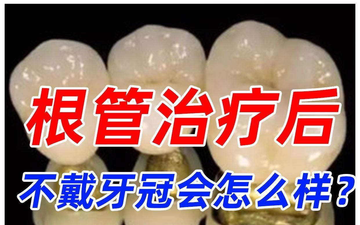 門牙根管治療后需要戴牙冠嗎，牙+牙治療后，是否需要戴牙冠