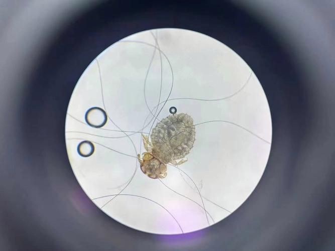 如何預防魚虱子的傳播，如何防治魚虱子