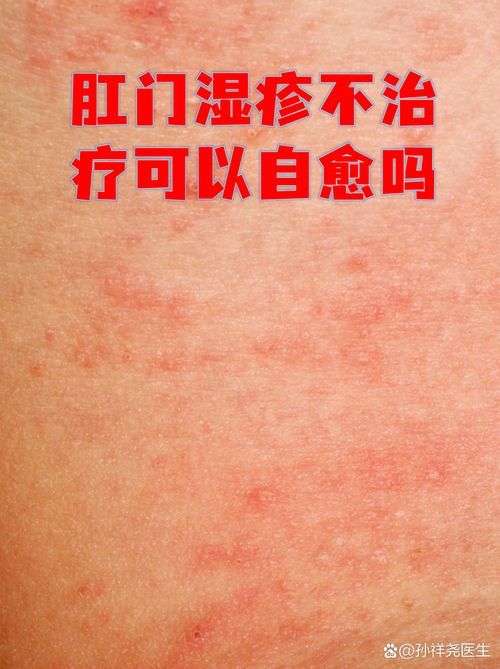 如何判斷龍魚腸胃炎的嚴重程度？，如何判斷龍魚腸胃炎