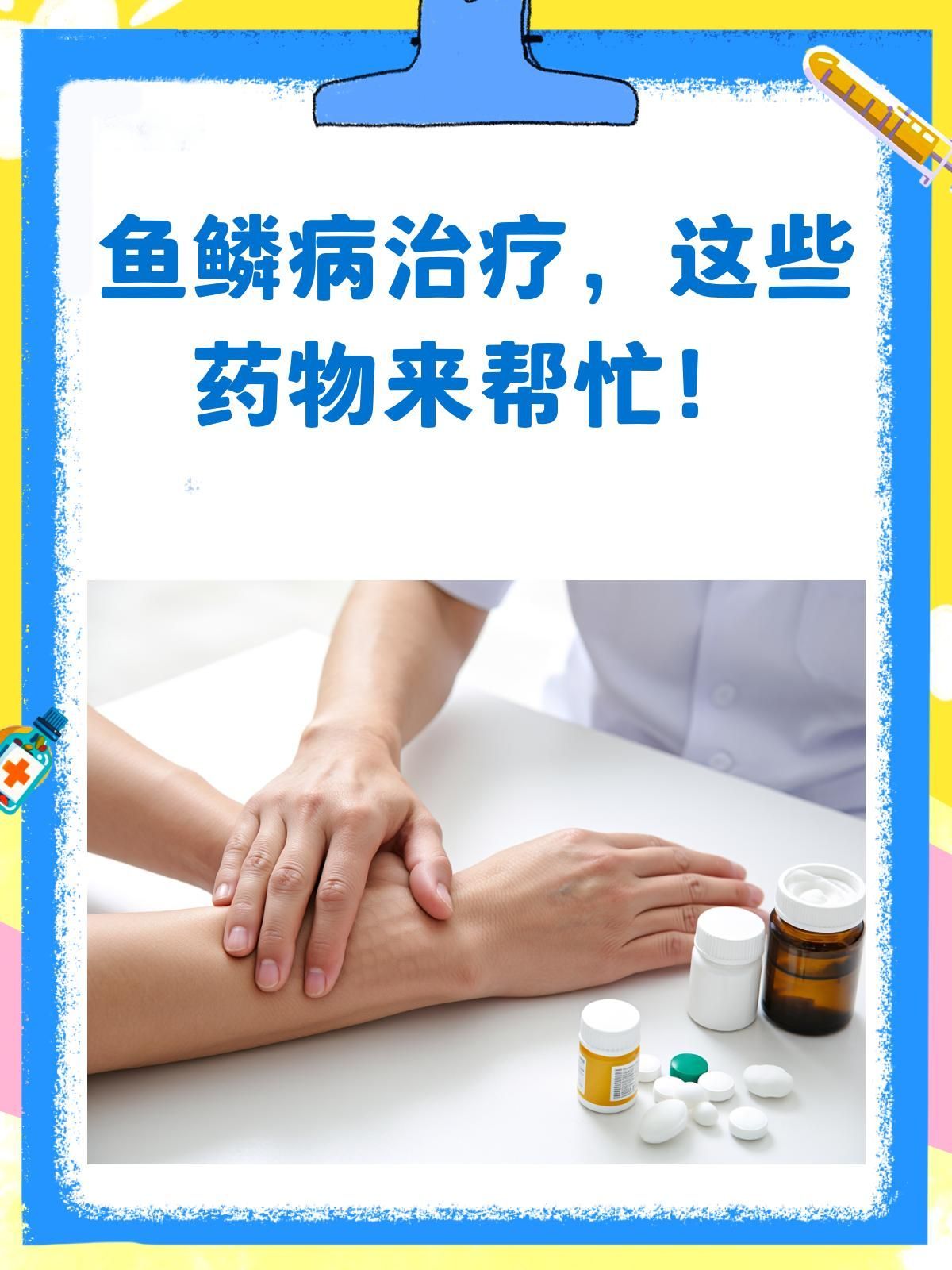 有哪些藥物可以有效治療魚鱗病，治療魚鱗病的藥物有哪些
