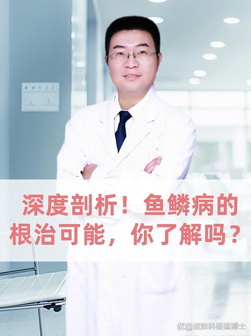有哪些藥物可以有效治療魚鱗病，治療魚鱗病的藥物有哪些