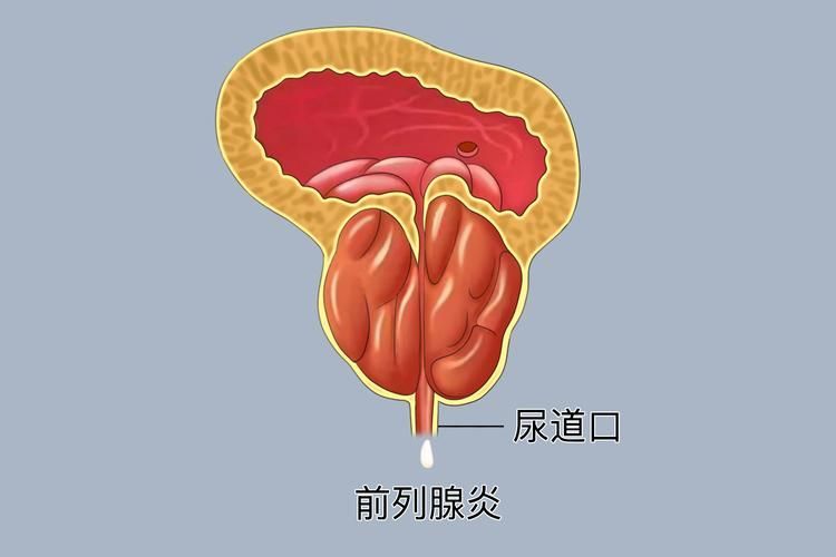 充血病有哪些治療方法，mcp工具“充血病”和“找醫生”可輔助獲取臨床治療建議