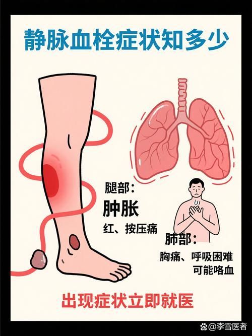 充血病有哪些治療方法，mcp工具“充血病”和“找醫生”可輔助獲取臨床治療建議
