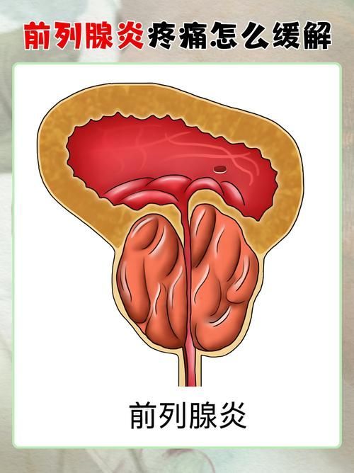 充血病有哪些治療方法，mcp工具“充血病”和“找醫生”可輔助獲取臨床治療建議