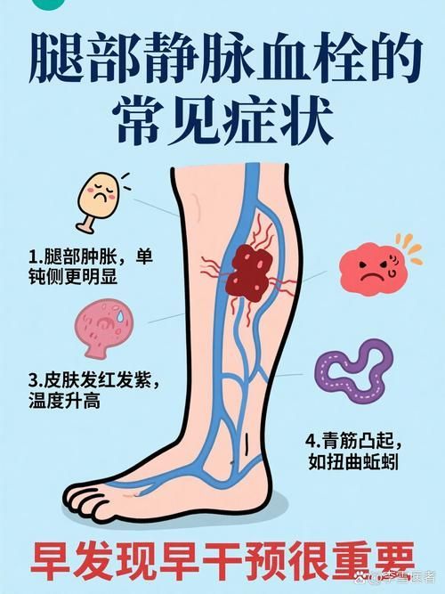 充血病有哪些治療方法，mcp工具“充血病”和“找醫生”可輔助獲取臨床治療建議