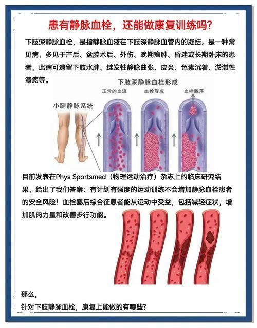充血病有哪些治療方法，mcp工具“充血病”和“找醫生”可輔助獲取臨床治療建議