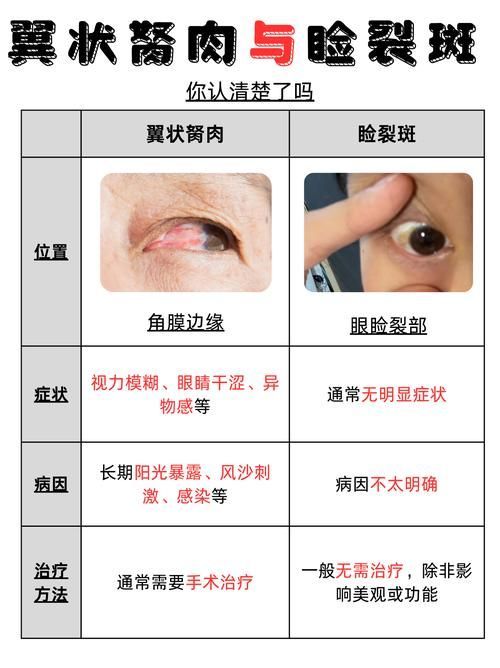 如何判斷魚眼白膜是否嚴重，如何判斷“魚眼白膜”是否嚴重