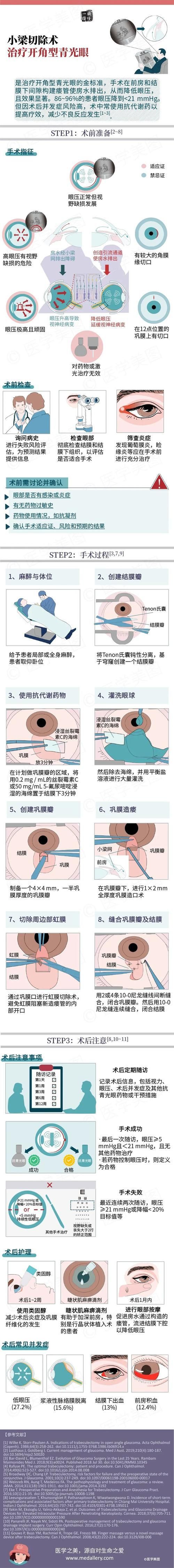 氣蒙眼手術風險大嗎，“氣蒙眼手術”手術風險
