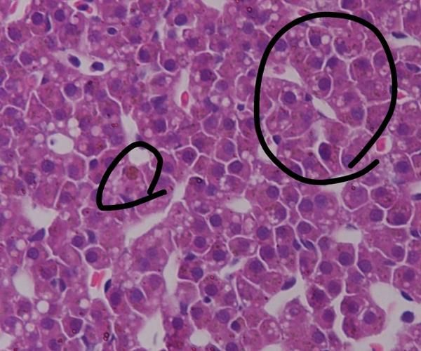 土霉素治療龍魚炸鱗的副作用有哪些？，土霉素治療龍魚炸鱗