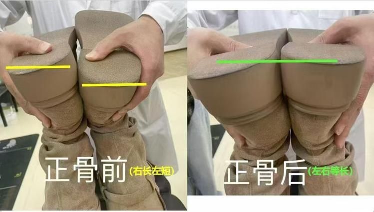 有哪些成功的龍魚咬嘴正骨手術案例，“龍魚咬嘴正骨手術”是否存在的觀賞魚醫療操作