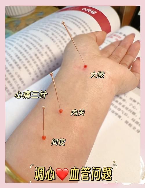 哪些疾病適合非藥物治療，非藥物治療適合非藥物治療疾病清單及其干預方式詳解