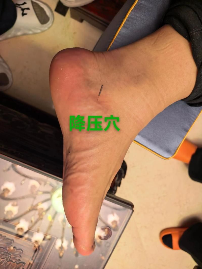 哪些疾病適合非藥物治療，非藥物治療適合非藥物治療疾病清單及其干預方式詳解