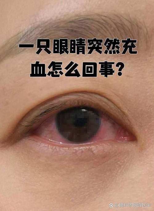 如何區分輕度、中度和重度充血，權威醫學圖譜類圖像與充血（congestion）的區分詳解