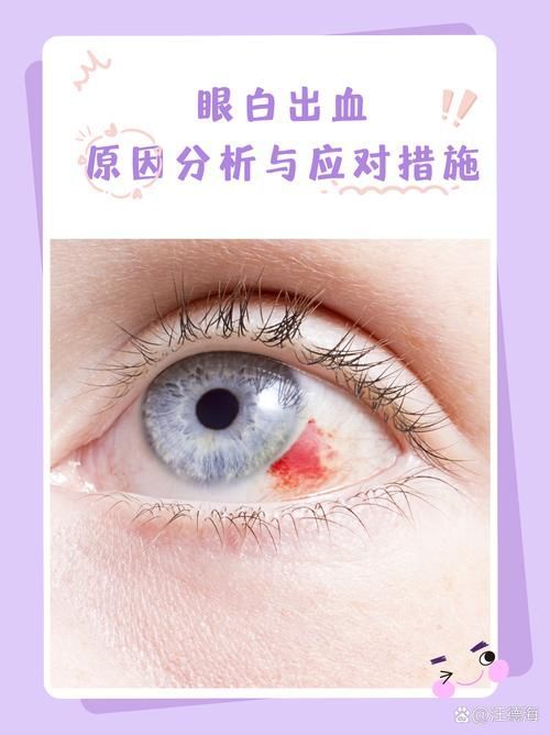 如何區分輕度、中度和重度充血，權威醫學圖譜類圖像與充血（congestion）的區分詳解