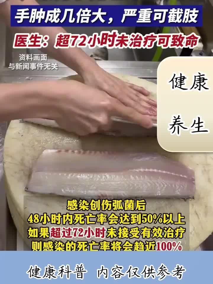 有哪些海洋細(xì)菌感染案例，2019年海洋細(xì)菌感染案例提醒我們需要時(shí)刻保持警惕
