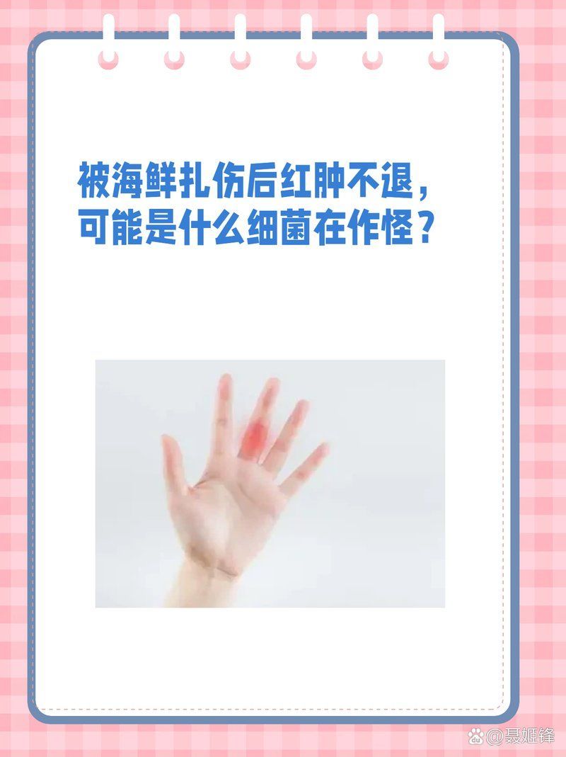 有哪些海洋細(xì)菌感染案例，2019年海洋細(xì)菌感染案例提醒我們需要時(shí)刻保持警惕