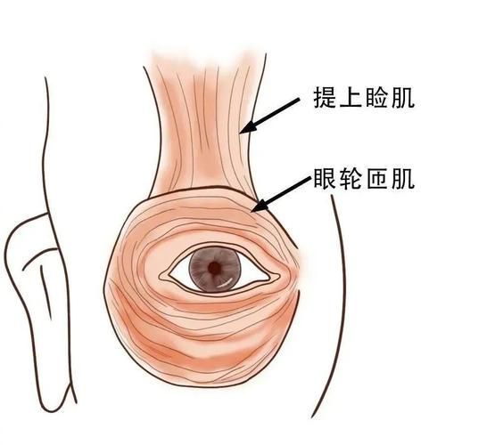 蒙眼和凸眼哪個更嚴(yán)重