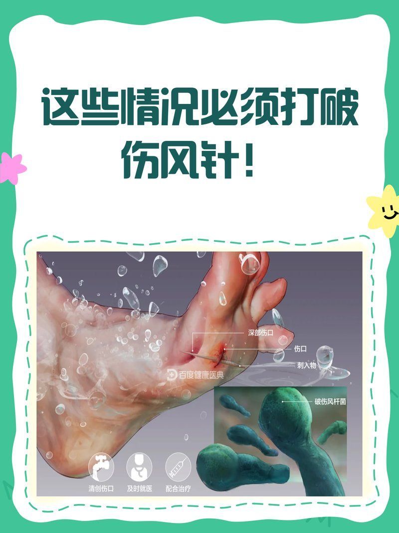 龍魚咬傷后需要打破傷風嗎，魚咬傷后需要打破傷風針取決于多個因素，醫生建議盡快就醫