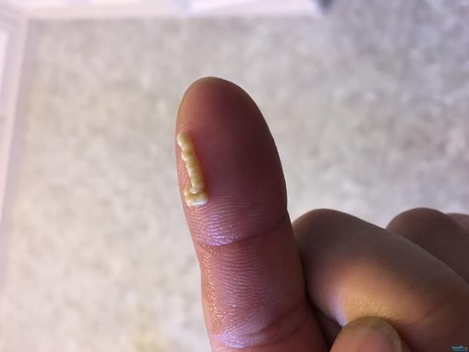 龍魚腸炎表現，龍魚腸炎如何診斷
