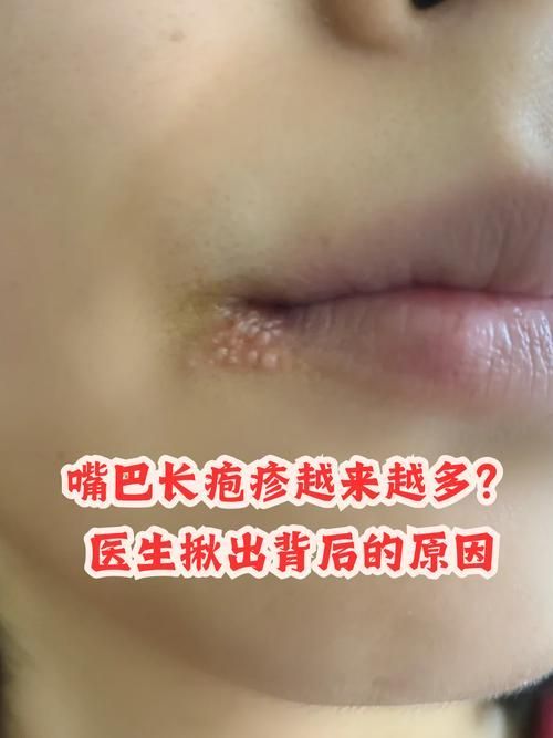 給我更多關于龍魚嘴上皰疹的圖片，龍魚嘴上皰疹怎么辦