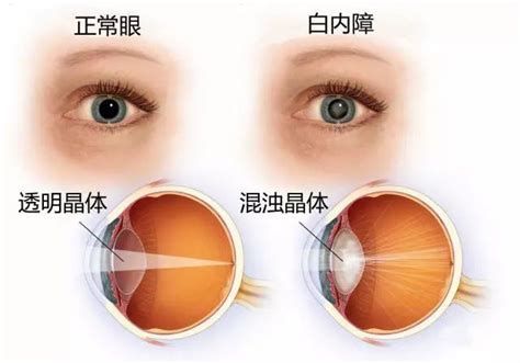如何區分龍魚眼球的白點是病還是其他原因？