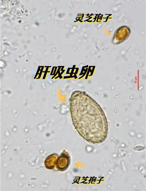 哪些魚類容易感染寄生蟲，————科學詳解與高風險物種清單 哪些魚類容易感染寄生蟲，————科學詳解與高風險物種清單 龍魚百科 第5張
