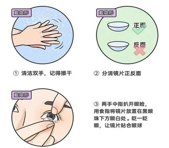 如何預防蒙眼病復發，“蒙眼病復發預防蒙眼病復發預防措施與配圖資源 如何預防蒙眼病復發，“蒙眼病復發預防蒙眼病復發預防措施與配圖資源 龍魚百科 第10張