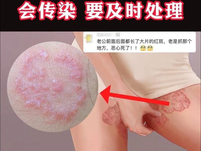 能否提供更多真菌和細菌感染的典型圖片，真菌與細菌感染對比圖鑒，紅龍魚的眼質問題如何判斷