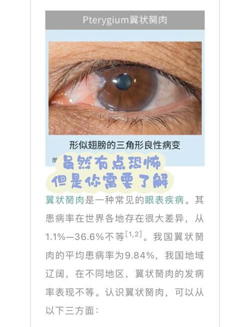 如何預防眼睛白膜,mcp工具調用戶要求詳解如何預防眼睛白膜需要1000字和配圖 龍魚百科 第5張 如何預防眼睛白膜,mcp工具調用戶要求詳解如何預防眼睛白膜需要1000字和配圖 如何預防眼睛白膜,mcp工具調用戶要求詳解如何預防眼睛白膜需要1000字和配圖 龍魚百科 第5張
