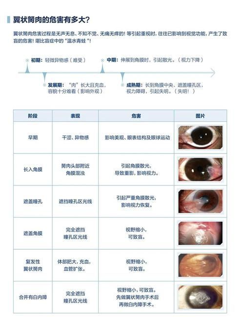 如何預防眼睛白膜,mcp工具調用戶要求詳解如何預防眼睛白膜需要1000字和配圖 龍魚百科 第6張 如何預防眼睛白膜,mcp工具調用戶要求詳解如何預防眼睛白膜需要1000字和配圖 如何預防眼睛白膜,mcp工具調用戶要求詳解如何預防眼睛白膜需要1000字和配圖 龍魚百科 第6張