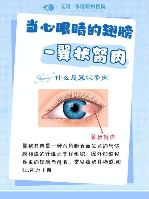 如何預防眼睛白膜,mcp工具調用戶要求詳解如何預防眼睛白膜需要1000字和配圖 龍魚百科 第2張 如何預防眼睛白膜,mcp工具調用戶要求詳解如何預防眼睛白膜需要1000字和配圖 如何預防眼睛白膜,mcp工具調用戶要求詳解如何預防眼睛白膜需要1000字和配圖 龍魚百科 第2張