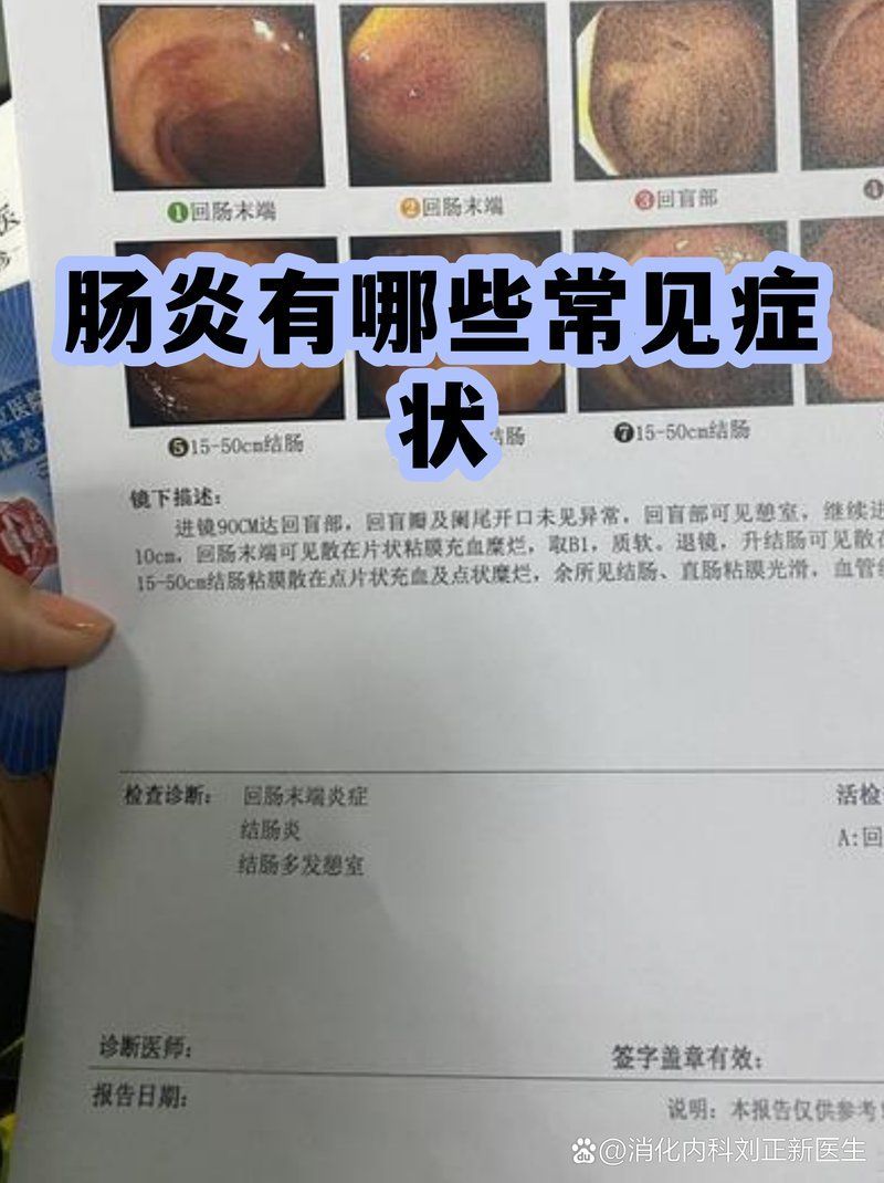 腸炎有哪些癥狀，腸炎有哪些常見癥狀